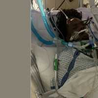 Support Swells, Family Wants Justice For Long Island Hit-Run Victim