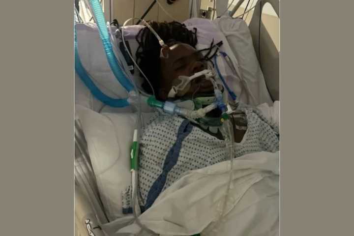 William Thomas, aged 24, was the victim of a hit-and-run in early May of 2023. While he begins his long journey to recovery, his family is raising money to help pay for his medical bills.