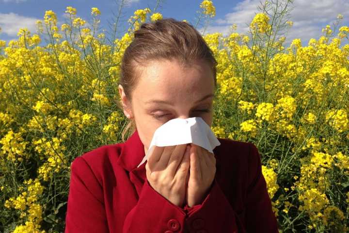 Your Allergies Are About To Get Way Worse; Holy Name Doc Has Tips