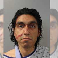 Long Island Man Admits Slashing Ex-Girlfriend's Family With Knife