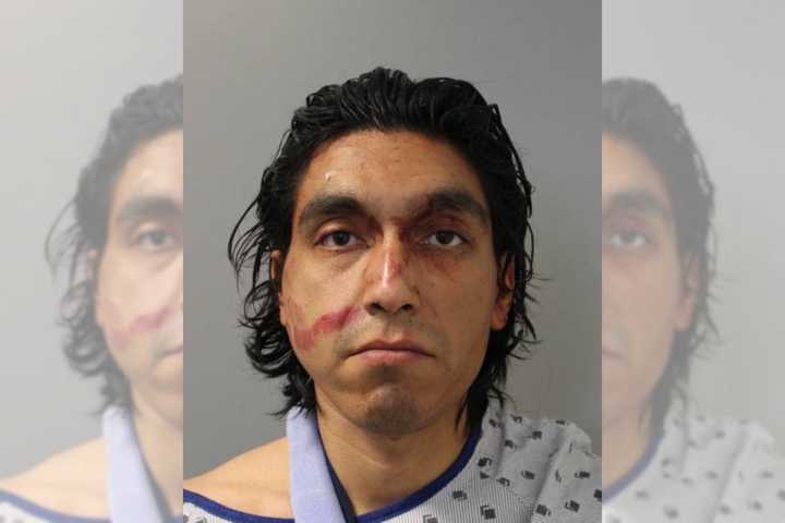 Razor-Wielding Calverton Man Who 'Terrorized' Family, Disfigured Victim's Face Gets 18 Years