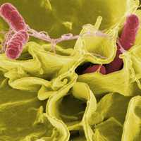 Public Health Alert Issued For Breaded Chicken Product Due To Possible Salmonella Contamination