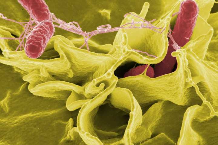 Cases Climb Of Nationwide Salmonella Outbreak From Unknown Food Source