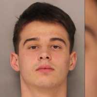 Beer Bottle Attack Leads To 'Severe Injuries' In Chesco: Police