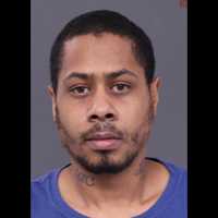 PD: Woman Airlifted After Being Punched In Head, Slashed With Broken Beer Bottle In Bucks Motel