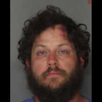 Belligerent Drunk Man Assaults Berks Hotel Employee, Police Say