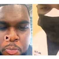Man Poses As Nurse To Kidnap, Sexually Abuse Women In NJ, NY: Feds
