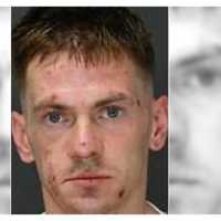 Polish Ex-Con Nabbed In Burglary Spree Bites Wallington Detective: Authorities