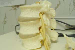 Community Is Welcome To Learn How To Beat Back Pain In North Arlington