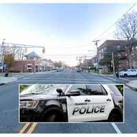 Pedestrian, 57, Struck In Teaneck, Driver From Cliffside Gets Summons