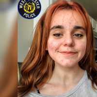 Missing Chesco Teen Located Safely: Police
