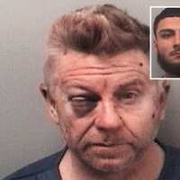 Driver, 58, Gets Worst Of Elmwood Park Brawl With Passaic Sheriff's Detectives