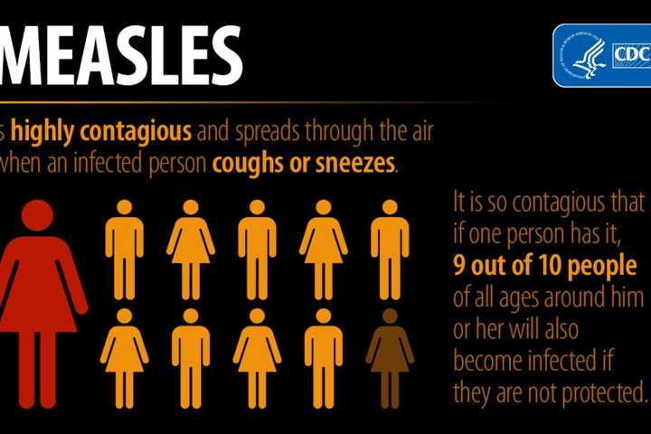 New York City Declares Measles Public Health Emergency In Select ZIP Codes