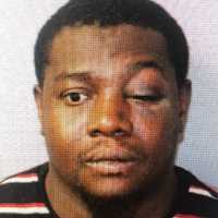 Bergenfield PD: Rowdy Restaurant Patron Sucker-Punches Officer In Buffet Brawl