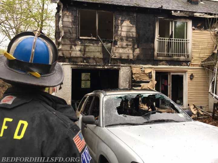 A car fire swiftly spread to a Mount Kisco home that was under renovation.