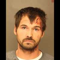 PA Man Named 'Moist' With DUI Record, Charged In 5 Vehicle Crash, Police Say