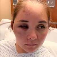 ‘Go Back To Mexico’: Boy, 13, Charged With Knocking Out Passaic Mom, Beating Son