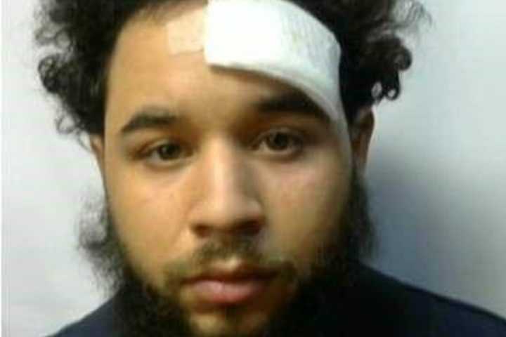 Man In Underwear Chased By Lancaster Police After Knocking Girl Unconscious