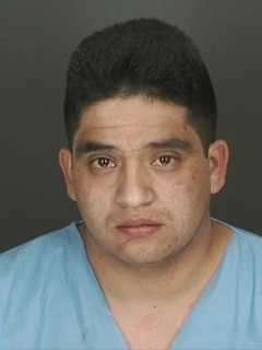 Police Arrest Man For Biting Off Part Of Nose In Peekskill Brawl