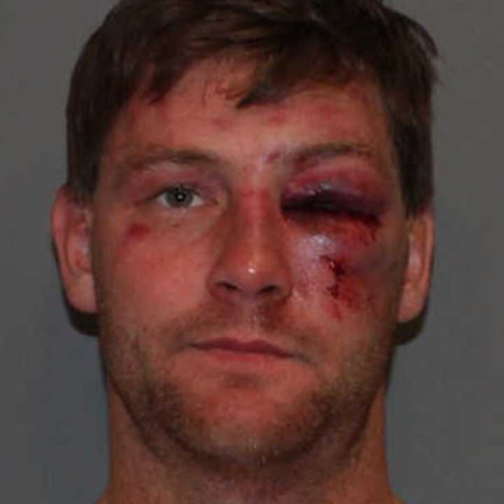 Christian Garnett, 32, was charged with assault on a police officer and driving under the influence Oct. 31 by Norwalk Police.