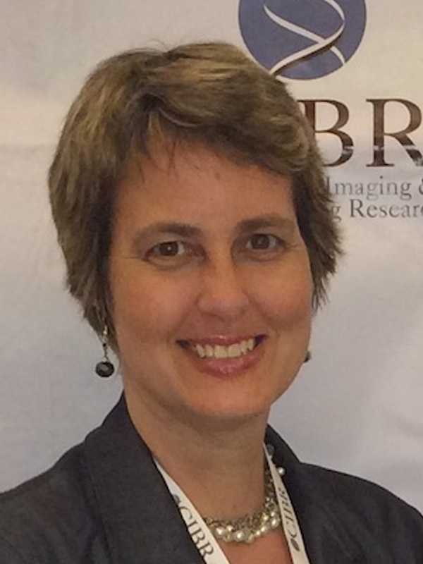 Norwalk Concussion Expert Wants More Education In Youth Leagues