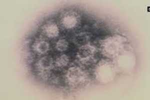 Expert: Soap, Water For Full 20 Seconds Will Kill Fatal Respiratory Virus
