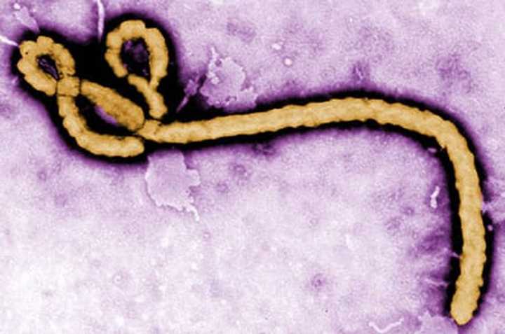 Gov. Andrew Cuomo outlined the state&#x27;s new preparedness plan for Ebola.