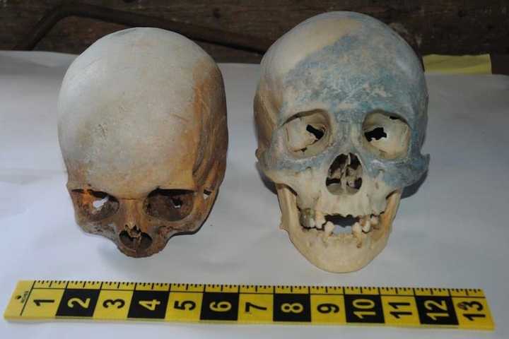 Two Human Skulls Found At Stamford Transfer Station, Police Say