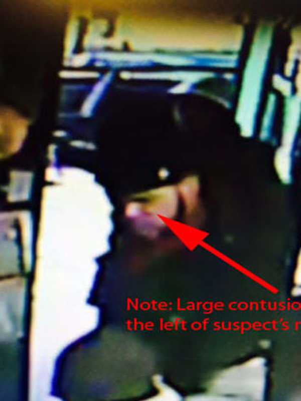 Stamford Police Seek Help In Finding Suspect In Attacks On Man, Clerk