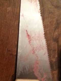 Man Charged In Handsaw Attack In Stamford That Injured Ex's New Boyfriend