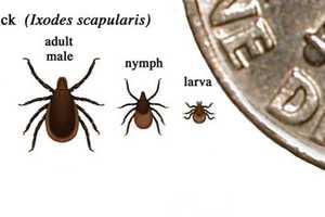 Experts Divided On Cure For Chronic Lyme Disease 