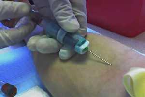 Blood Tests  May Reveal Cancer, Research Finds