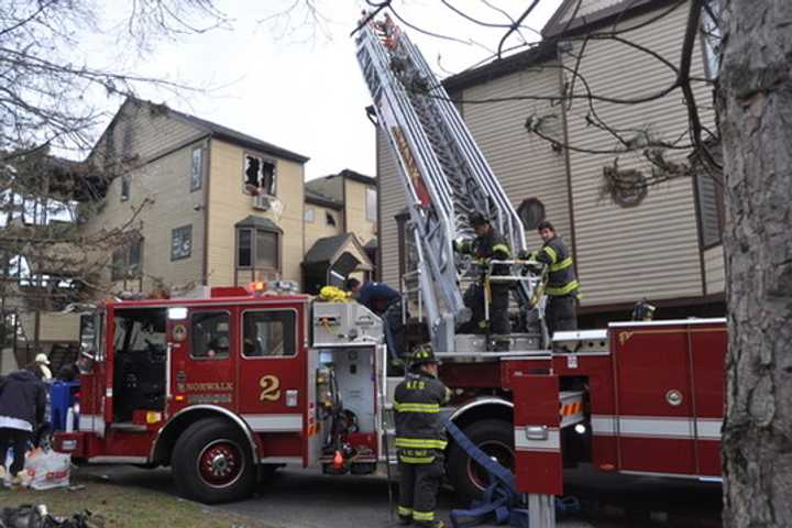 Man Suffers Burns In Norwalk Fire