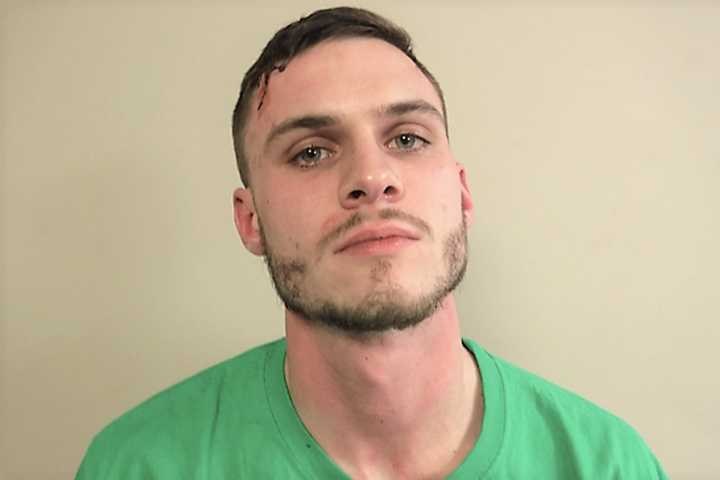 New Milford PD: Unwanted Borough Guest Hospitalized After Scuffle With Police