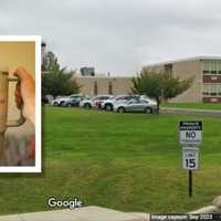 Student's Head Stapled After 'Unprovoked' PA Stanley Cup Attack: Report