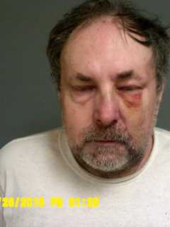 Fairfield Man Charged With Wrong-Way Speeding On Route 8 In Shelton