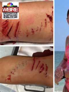 Pennsylvania Girl Attacked By Shark