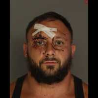 Violent Cumberland County Drunk Driver Spits Blood In Paramedic's Face, Authorities Say