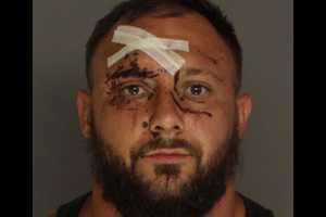 Violent Cumberland County Drunk Driver Spits Blood In Paramedic's Face, Authorities Say