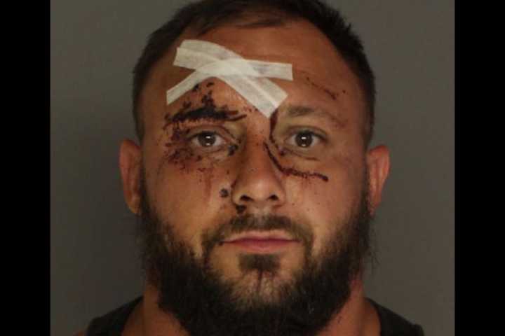 Violent Cumberland County Drunk Driver Spits Blood In Paramedic's Face, Authorities Say