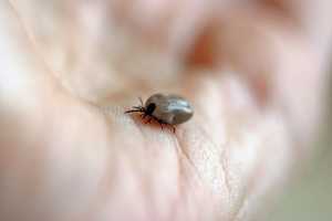 Severe Tickborne Disease On Rise In Putnam County: Here's How To Prevent It