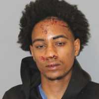 Firefighters Injured, Driver Charged After Fiery Crash In New Haven,