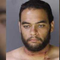 Attempted Homicide For Machete-Wielding Attacker In Bucks: Authorities