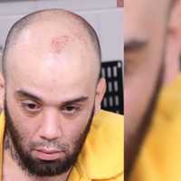 Domestic Violence Suspect Assaults Nurses, Doctors In Bucks County: Authorities