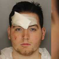 Chesco Thief Who Stabbed Cop In Head Learns His Fate