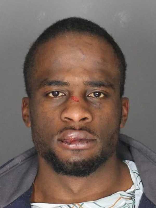 Police Charge 25-Year-Old Who Fled Port Chester Hit-Run Assault