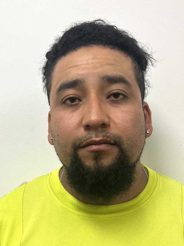 Man Charged With Child Abuse In Bergen County: Prosecutor