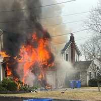 Woman Badly Burned In Suspicious Tenafly House Fire, Arson Investigators On Scene: Officials