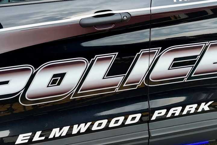 Teen Shot In Broad Daylight In Elmwood Park, Police Say