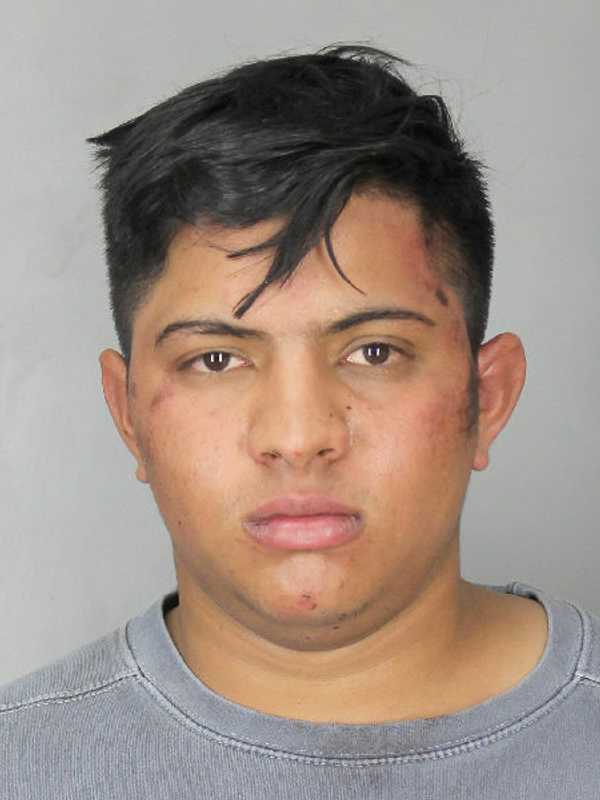 Teen Crashes Stolen Mercedes, Attempts To Assault Responding Officer On Long Island: Police